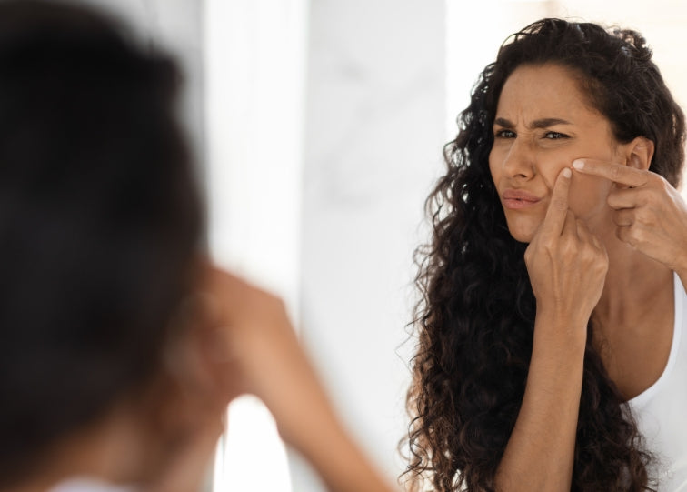 Don't Pop Your Acne, Dry it Out!