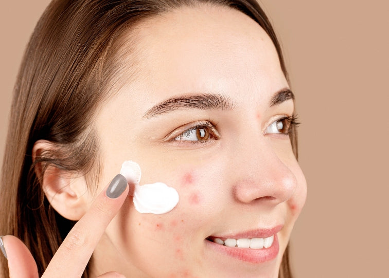 4 Blemish Types and How to Manage Them