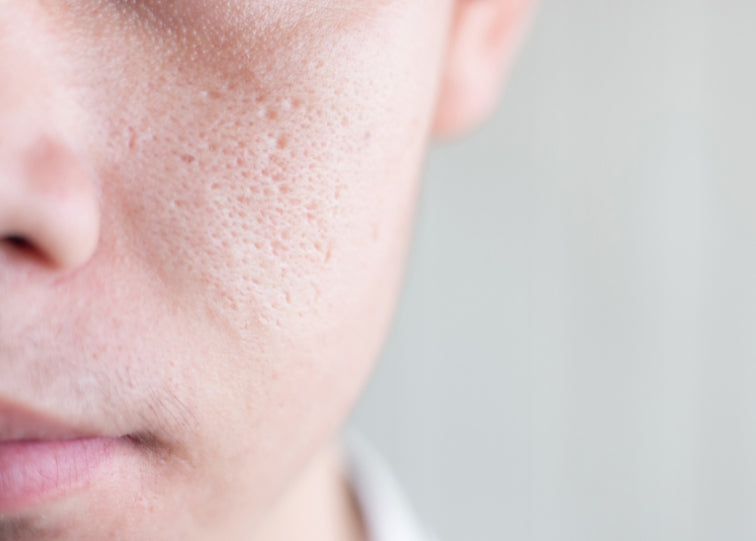 up close skin of large pores