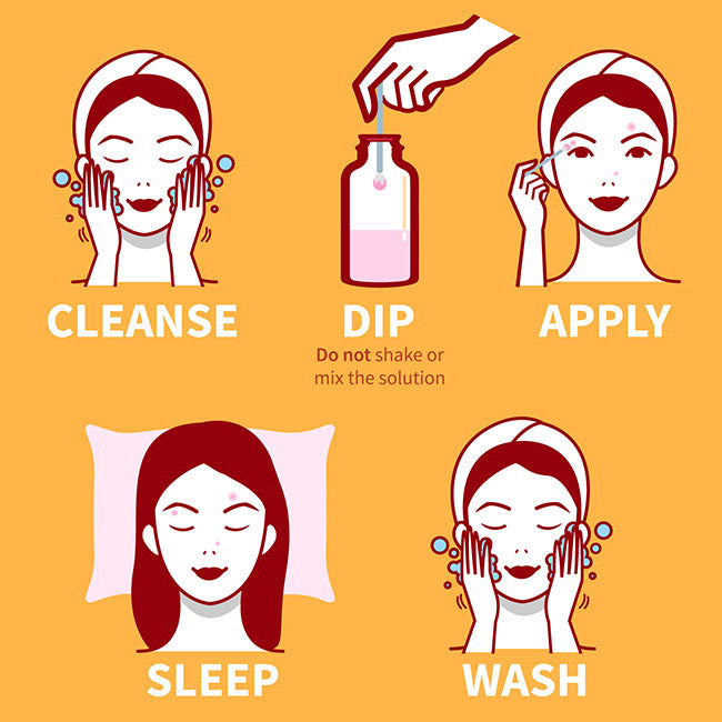 How To Apply a Acne Drying Lotion
